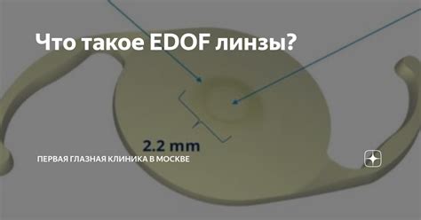 Что такое EDOF линзы? | Первая глазная клиника в Москве | Дзен