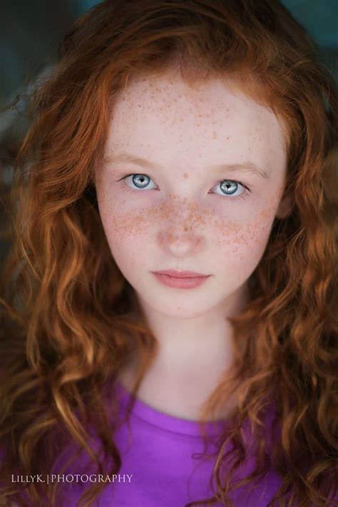 Honey Blonde Hair Ginger Hair Cute Ginger Beautiful Freckles Freckles Girl Freckle Face