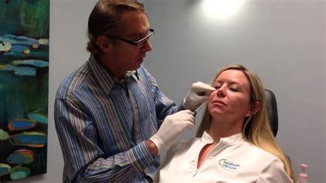 Belllafill Volumization Of The Cheeks Pre Jowl Sulcus Jawline Steve
