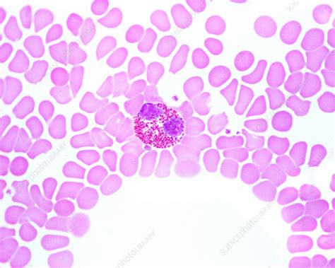 Human Blood Smear With Eosinophil Light Micrograph Stock Image