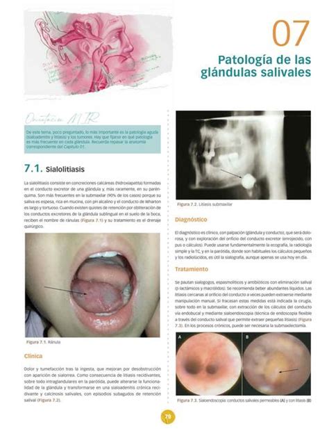 Patolog A De Las Gl Ndulas Salivales Full Ciencia Udocz