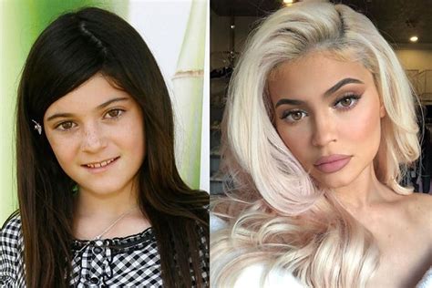 Kylie Jenner Before Plastic Surgery: The Beauty Mogul's Early Days ...