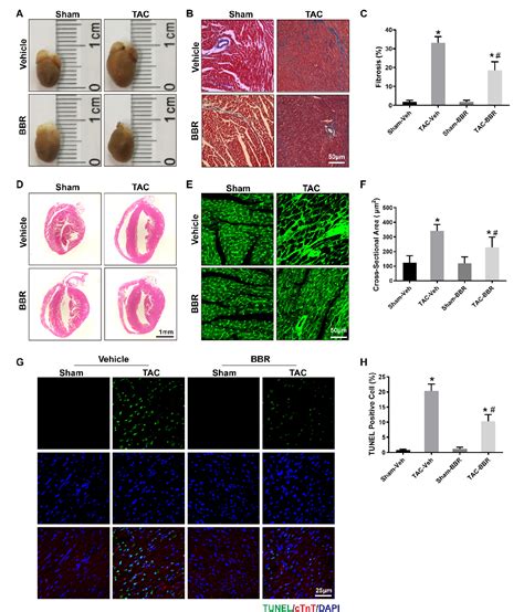 Figure 2 From Berberine Promotes Cardiac Function By Upregulating PINK1