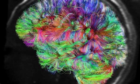 Lsd Changes Consciousness By Reorganizing Human Brain Networks