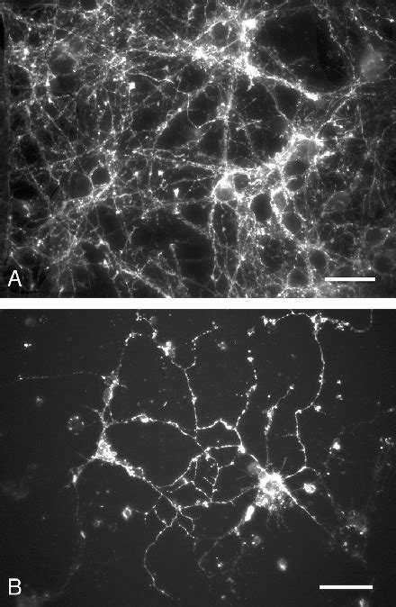 Immunocytochemical Analysis Of The Expression Of Synaptic Markers In