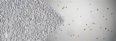 Which Significance Do Hela Cells Still Have Today Anvajo