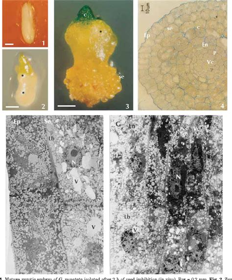 Figure From Ultrastructural Changes In Zygotic Embryos Of Gentiana