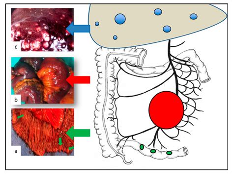 Jcm Free Full Text Surgery And Perioperative Management In Small