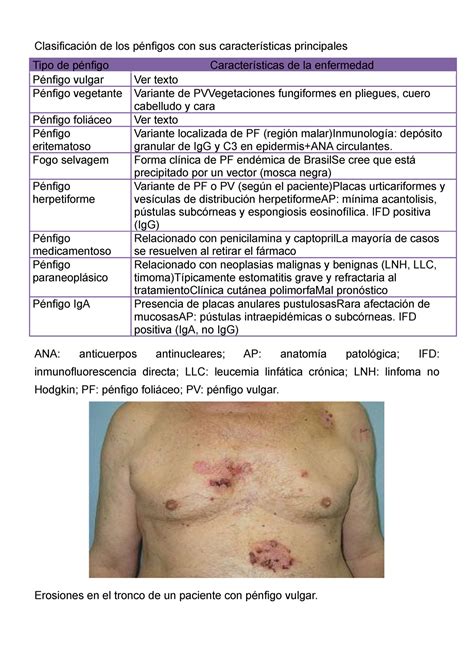 Dermatologia Clasificación de los pénfigos con sus características