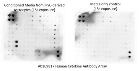 Cytokine Array Human Cytokine Antibody Array Membrane 60 Targets