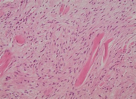 Proliferation Of Fusiform Cells Dissociating Striated Muscle Fibers Download Scientific