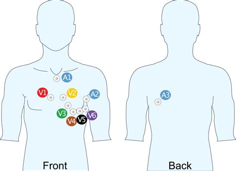 diagnosis posterior ekg lead placement