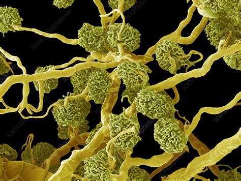 Kidney glomeruli, SEM - Stock Image - P550/0205 - Science Photo Library