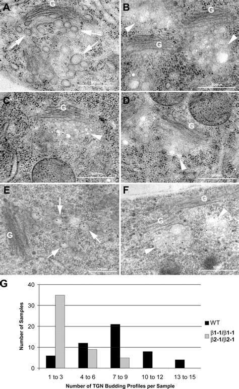 RabA4b labeled membranes have altered morphologies in PI 4Kβ1 β2 double