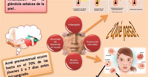 DIVULGACIÓN CIENTÍFICA UG Acné