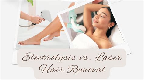 Electrolysis Vs Laser Hair Removal Which Is Best