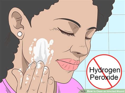 Ways To Clean An Infected Wound Wikihow