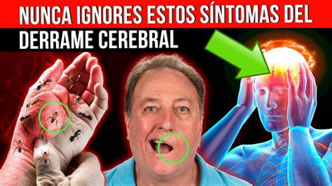 Derrame Cerebral Reconoce Las Se Ales De Advertencia En Pasos