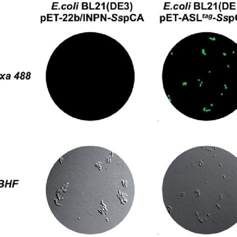 Fluorescence Microscopy Of E Coli Bl De Cells Transformed With