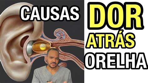 Dor Embaixo Da Orelha