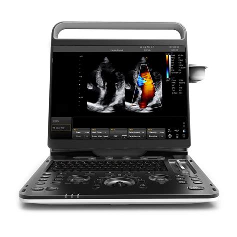 4D 5D Trolley Color Doppler Ultrasound Cardiac Vascular Echo Msk USG