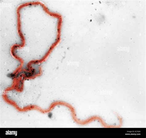 Treponema pallidum shown under dark field light microscopy Stock Photo ...