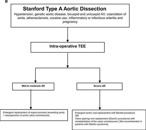 Aortic Regurgitation Pathophysiology