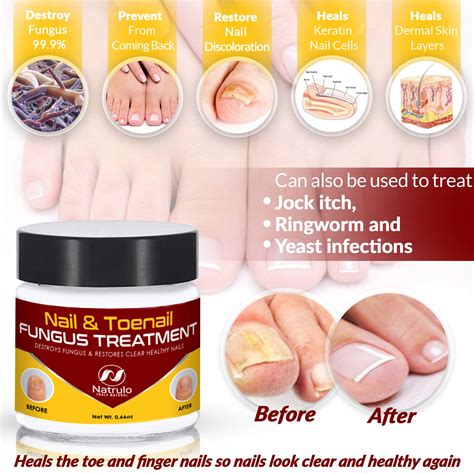 Natrulo Nail & Toenail Treatment - Herbal Nail Cream with Tolnaftate ...