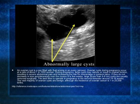 Ovarian Cyst During Pregnancy Dangerous And Symptoms Causes And