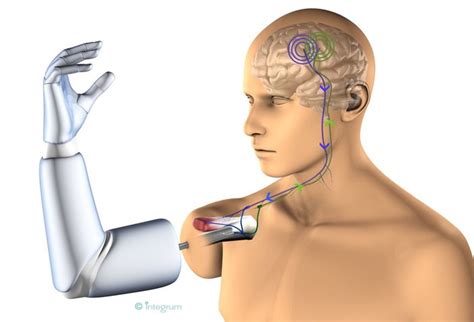 Brain Computer Interfaces — Institute Of Biomedical Engineering And