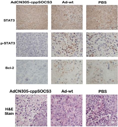 Immunohistochemical Staining For Phospho Stat And Histopathological