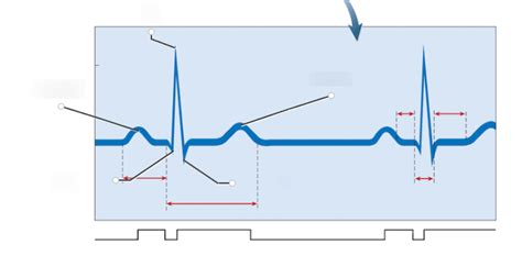 identifying  waves   normal ecg diagram quizlet