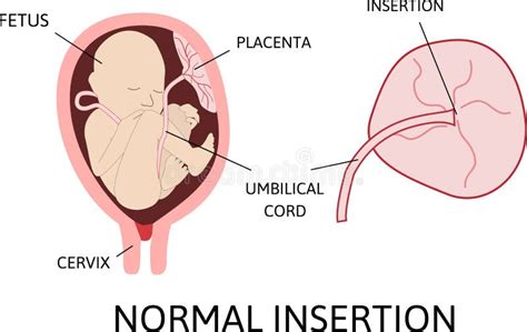 Gravidez Normal Anatomia Feminina Ilustração De Poster De Vetor