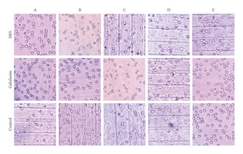 Trypan Blue Exclusion Test Of Wbcs Showing Very High Cell Viability Download Scientific Diagram