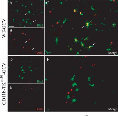 Figure 1 From Selective Ablation Of Proliferating Microglial Cells