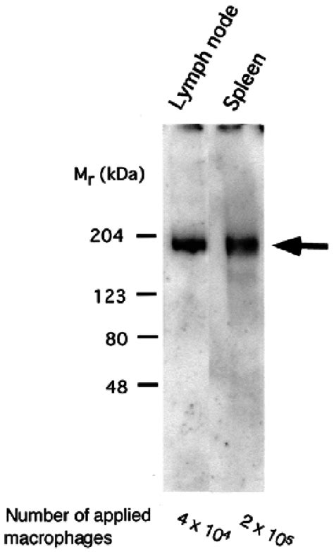 Western Blot Analysis Of Sn In Macrophage Enriched Fractions