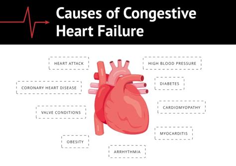 congestive heart failure types symptoms  treatment
