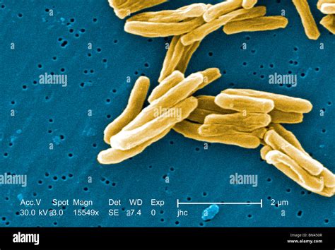 Mycobacterium Tuberculosis Sem Hi Res Stock Photography And Images Alamy