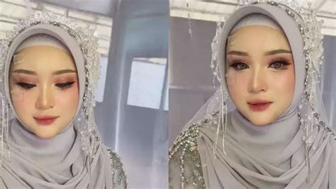 Pengantin Wanita Kecelakaan H 3 Menikah Wajah Bonyok Penuh Luka Hasil