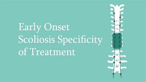 Early Onset Scoliosis Specificity Of Treatment — Eccelearning