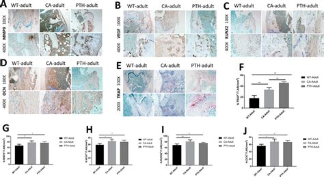 Immunostaining For A Mmp B Vegf C Runx And D Ocn And E Trap