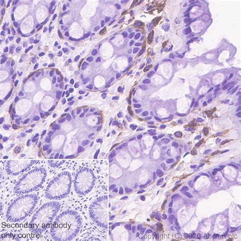 Recombinant Anti Pdgfr Alpha Antibody Epr Bsa And Azide Free Ko