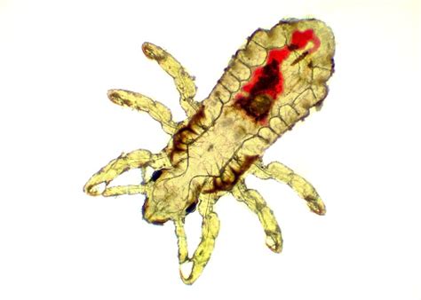 Piolho-de-cobra Porque Aparece - Foto de Piolho De Cabeça Pediculus Capitis Imagens De Microscópio e ...