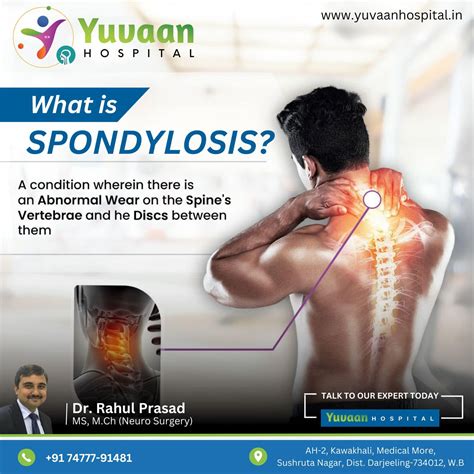 Yuvaan hospital - What is Spondylosis Neelakshi Prasad... | Facebook