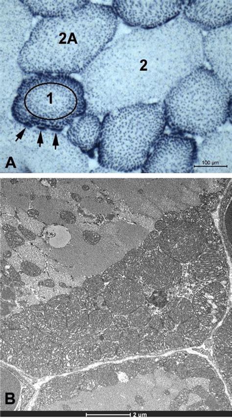 Mitochondrial Evidence Of Fes Effectiveness A Nadh Tr Stain Type