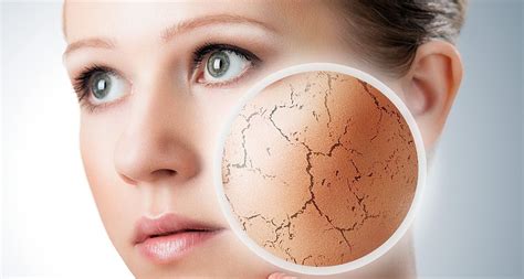 انواع بیماری های پوستی و عارضه های آن محصولات چوبی چارچوق