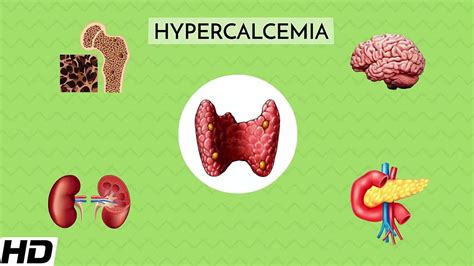 Hypercalcaemia: Everything You Need to Know - YouTube