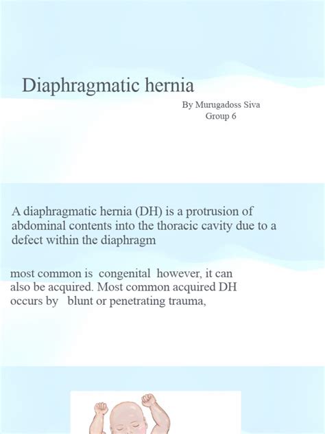 Diaphragmatic hernia | PDF | Esophagus | Diseases And Disorders