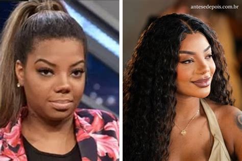 Ludmilla Antes E Depois Cirurgia