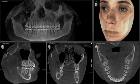Cbct And Panoramic X Ray Salloum Dental Clinic